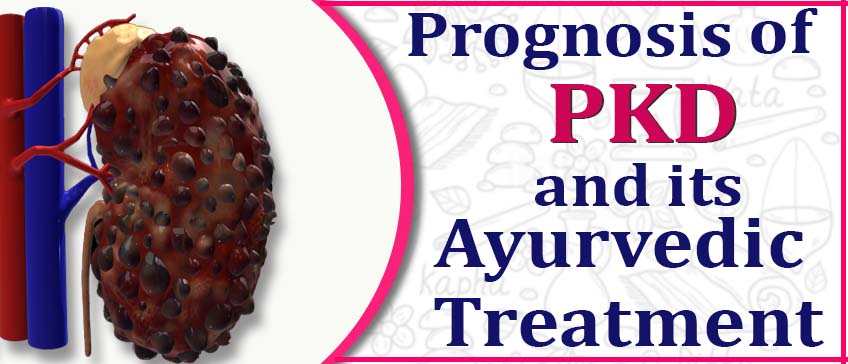 Prognoses of PKD and its Ayurvedic treatment