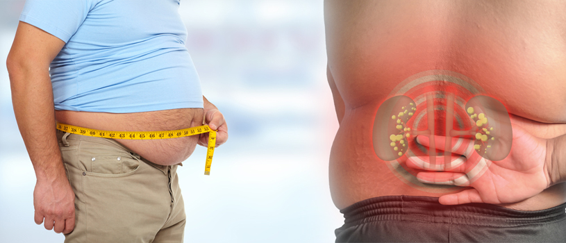 Obesity-Affects-Kidney-Disease-Patient