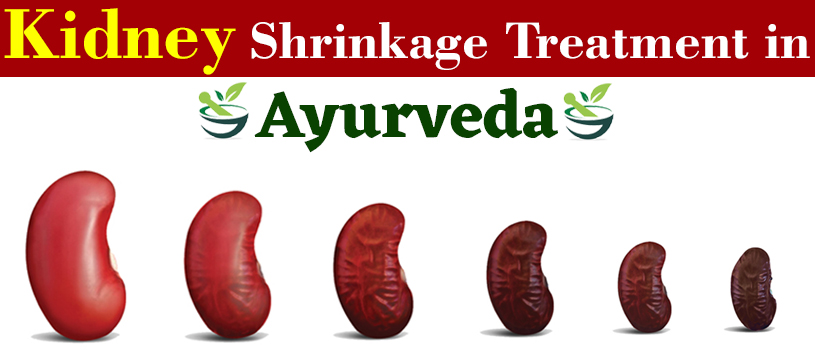 ayurvedic treatment shrinkage kidney