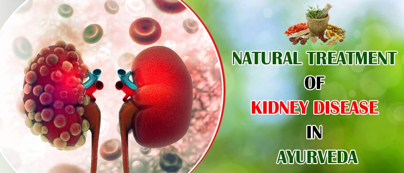 Natural treatment kidney disease in Ayurveda