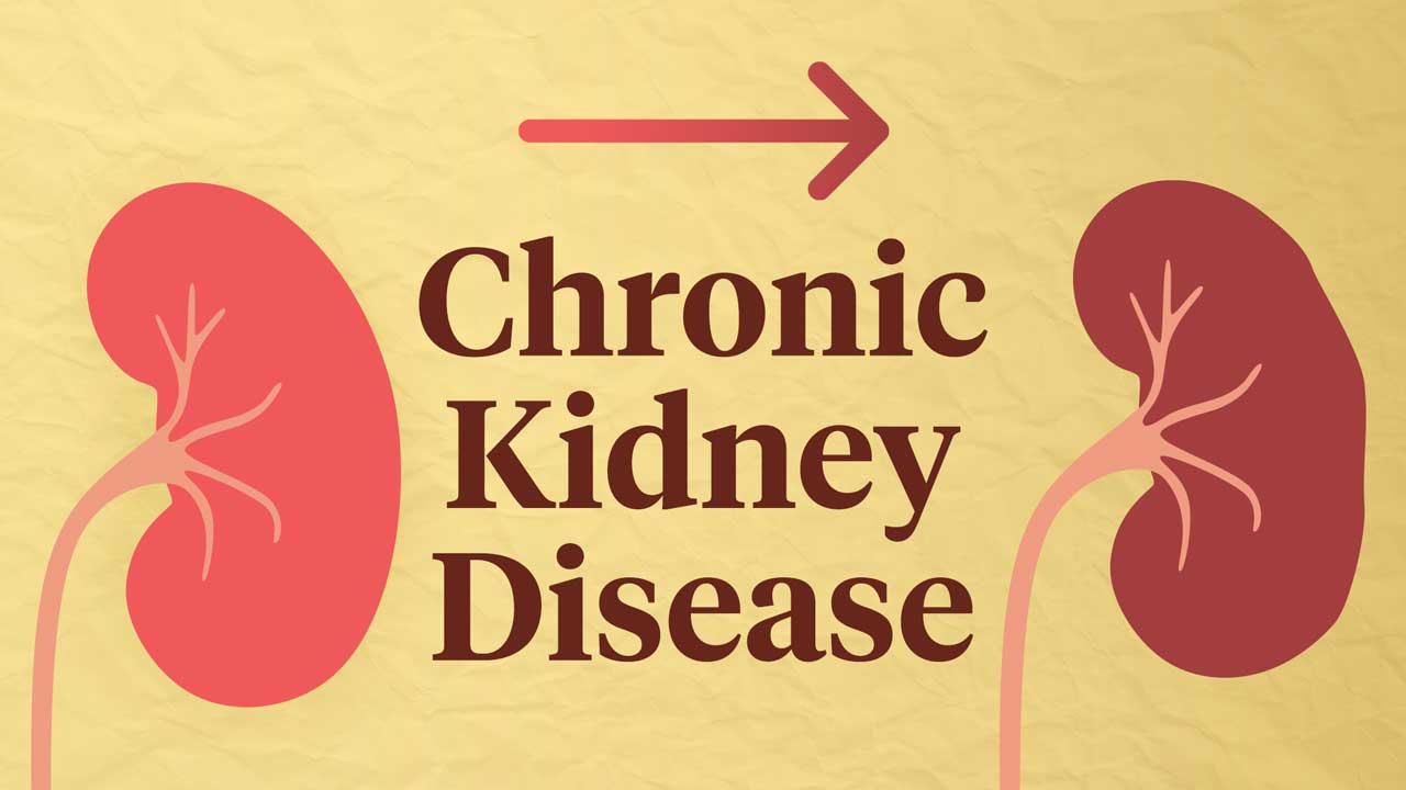 chronic-kidney-paitents