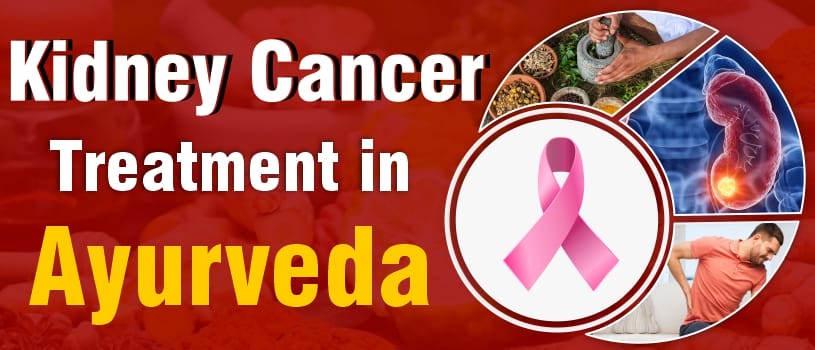 cancer-treatment-ayurvedic