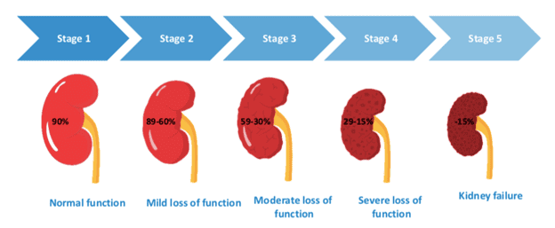 kidney-failure-stages