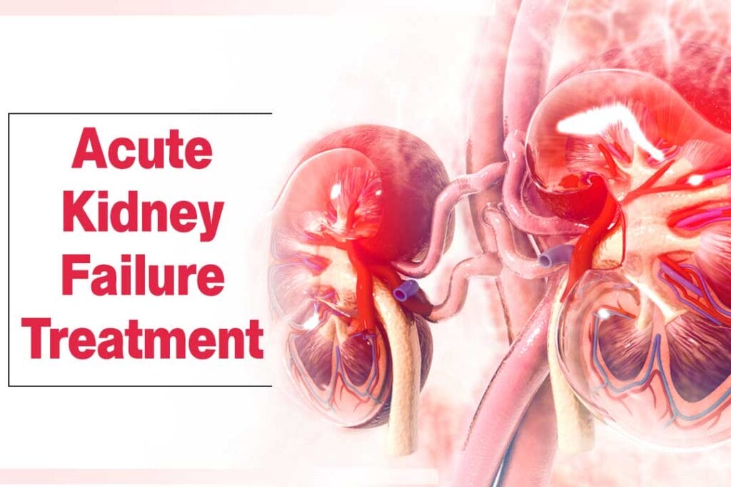 Acute-Kidney-Failure-treatment