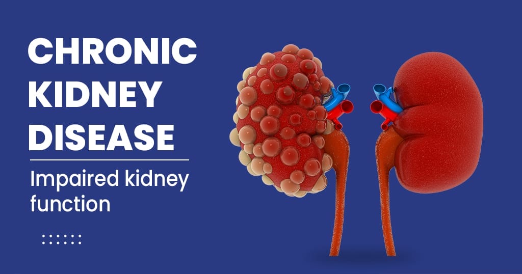 chronic-kidney-failure