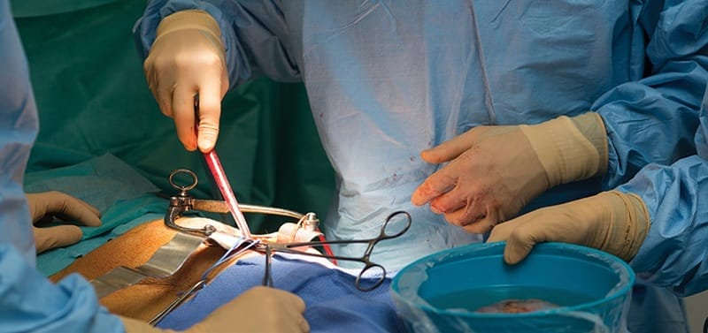 kidney-transplant-treatment
