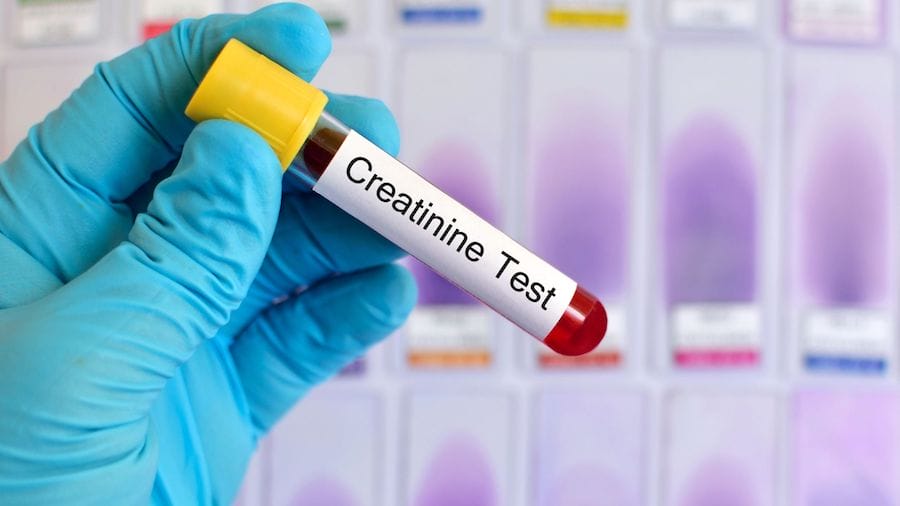 creatinine-level